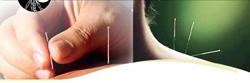 Brampton Acupuncture & Massage Therapy Clinic