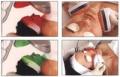 Photorejuvenation