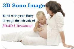 3d Sono Image Ultrasound