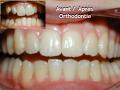 Orthodontie
