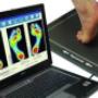 We use GaitScan technology to create custom orthotics and footwear We use GaitScan technology to create custom orthotics and footwear