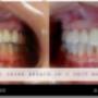 CEREC TECHNOLOGY CEREC TECHNOLOGY
