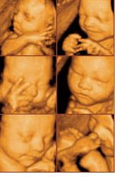 Fetal Expressions Inc