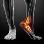 Common area of foot pain Common area of foot pain