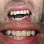 Our goal is to assist each patient in achieving and maintaining long term dental health and a beautiful smile. Our goal is to assist each patient in achieving and maintaining long term dental health and a beautiful smile.