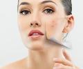 pigmented-treatment