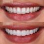 Danforth Dentistry - whitening Danforth Dentistry - whitening