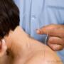 Chargé par visiteur le 2017-01-26 - Calgary acupuncture Chargé par visiteur le 2017-01-26 - Calgary acupuncture