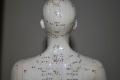 Acupuncture