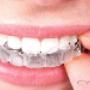 Chargé par visiteur le 2018-10-03 - smile make over Chargé par visiteur le 2018-10-03 - smile make over
