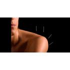 Clinique d'acupuncture Christine Dumais
