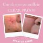 Ligne Clear Proof cette ligne est conçu pour ciblé les clients qui ont problème acné légère a modéré Ligne Clear Proof cette ligne est conçu pour ciblé les clients qui ont problème acné légère a modéré