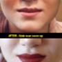 This is an example of a scar that has been concealed with the use of permanent makeup. Please notice the scar on the girl’s upper lip in the first photo. This is an example of a scar that has been concealed with the use of permanent makeup. Please notice the scar on the girl’s upper lip in the first photo.