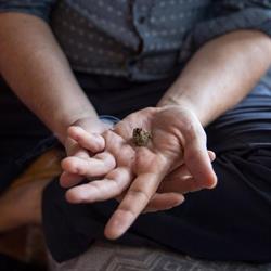 Live Hand Acupuncture