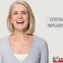 dental implants in toronto dental implants in toronto