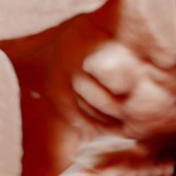 Baby SonoShow