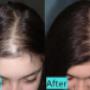 Hair growth treatments Hair growth treatments