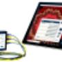 NeurOptimal® Neurofeedback Rental Systems. NeurOptimal® Neurofeedback Rental Systems.