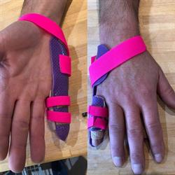 Alpine Hand Clinic