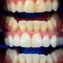 Horizons Dental Care
2255 Carling Ave
Ottawa, ON K2B 7Z5, Canada
https://www.horizonsdentalcare.ca/ Horizons Dental Care
2255 Carling Ave
Ottawa, ON K2B 7Z5, Canada
https://www.horizonsdentalcare.ca/