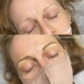 Microblading