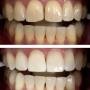 GT Dental Centre: Cosmetic & Family Dentist
308 Dundas Street West; Unit 2
Whitby, ON L1N 2M5
https://www.gtdentalcentre.com/ GT Dental Centre: Cosmetic & Family Dentist
308 Dundas Street West; Unit 2
Whitby, ON L1N 2M5
https://www.gtdentalcentre.com/