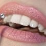 Tooth Gem Application Tooth Gem Application