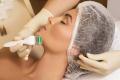 Microneedling