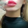 EverYouthLab #1 Treatment is Injectables by professional team of physician and nurses. you will be in right hand. EverYouthLab #1 Treatment is Injectables by professional team of physician and nurses. you will be in right hand.