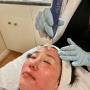 EverYouthLab Microneedling procedure with Skinpen #1 microneedling pen approved by health Canada.
This Treatment can stimulate the produce of collagen, Which is effective at treating scars, wrinkles, large pores, and stretch marks. EverYouthLab Microneedling procedure with Skinpen #1 microneedling pen approved by health Canada.
This Treatment can stimulate the produce of collagen, Which is effective at treating scars, wrinkles, large pores, and stretch marks.
