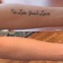 Before & After Forearm Tattoo Removal Before & After Forearm Tattoo Removal