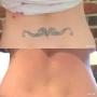 Before & After Lower Back Tattoo Removal Before & After Lower Back Tattoo Removal