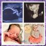 Look at this wonderful collage of this beautiful baby girl we were fortunate enough to image. Notice how the angle of the 3D image and the newborn are so very similar and you can even appreciate the similarities in features from the 2D image as well! Look at this wonderful collage of this beautiful baby girl we were fortunate enough to image. Notice how the angle of the 3D image and the newborn are so very similar and you can even appreciate the similarities in features from the 2D image as well!