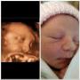 This family was in for a 3D scan a few months ago, and just had their daughter at the end of April. What a great before and after photo! This family was in for a 3D scan a few months ago, and just had their daughter at the end of April. What a great before and after photo!