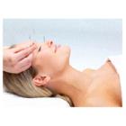 Wing Chee Acupuncture & Skin Care