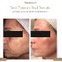 It's officially peel season!
We are now offering chemical peels from Alumier MD.
Chemical peels are the most effective treatment for anyone who has pigmentation, discolouration, acne and wrinkles.
Who's ready to shed some dead skin?! It's officially peel season!
We are now offering chemical peels from Alumier MD.
Chemical peels are the most effective treatment for anyone who has pigmentation, discolouration, acne and wrinkles.
Who's ready to shed some dead skin?!