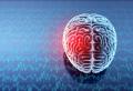 Concussion Physiotherapy