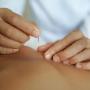 Dry Needling/IMS
Intramuscular stimulation is a treatment technique that is used to release or lengthen muscles that may be contributing to chronic musculoskeletal or neuropathic pain. Very fine needles are inserted directly into the affected muscle Dry Needling/IMS
Intramuscular stimulation is a treatment technique that is used to release or lengthen muscles that may be contributing to chronic musculoskeletal or neuropathic pain. Very fine needles are inserted directly into the affected muscle