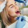 Dental fillings in Burlington Dental fillings in Burlington