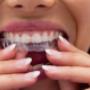 Invisalign in Burlington Invisalign in Burlington