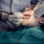 Periodontal Surgery in Burlington Periodontal Surgery in Burlington