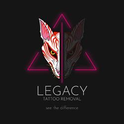 Legacy Tattoo Removal Limited