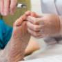 Foot | Chiropody Clinic \@ Thorncliffe Park
* Shockwave Therapy
* Chiropody Treatments
* Corn & Callus Removal
* Wart Removal/Treatment
* Diabetic Foot Care
* Ingrown Toe Nail Surgery
* Orhopaedic Footwear
* Custom Orthotics
* Medical Stockings Foot | Chiropody Clinic \@ Thorncliffe Park
* Shockwave Therapy
* Chiropody Treatments
* Corn & Callus Removal
* Wart Removal/Treatment
* Diabetic Foot Care
* Ingrown Toe Nail Surgery
* Orhopaedic Footwear
* Custom Orthotics
* Medical Stockings