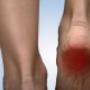 Heel Spur Treatments
- Shockwave Therapy
- Ultrasound Therapy
- Injection of Anti-inflammatory Medications
- Custom Made Orthotics with Heel Spur Pad/Hole in Heel Heel Spur Treatments
- Shockwave Therapy
- Ultrasound Therapy
- Injection of Anti-inflammatory Medications
- Custom Made Orthotics with Heel Spur Pad/Hole in Heel