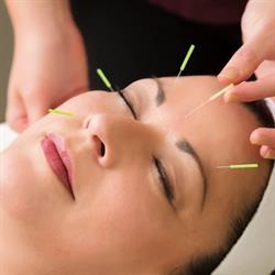 Lai & Associés Acupuncture