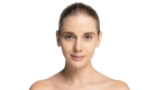 posse-facial-treatment-before-after-one posse-facial-treatment-before-after-one
