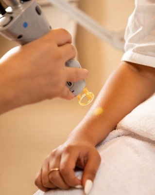Pre-Wedding Brazilian Laser Hair Removal