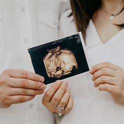 Royal Baby Vision 3D/4D Ultrasound Studio