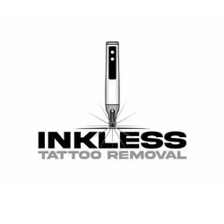 Inkless Tattoo Removal