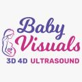 3d 4d baby visuals